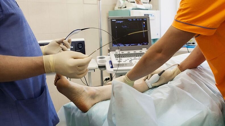 cirugía para eliminar las venas varicosas